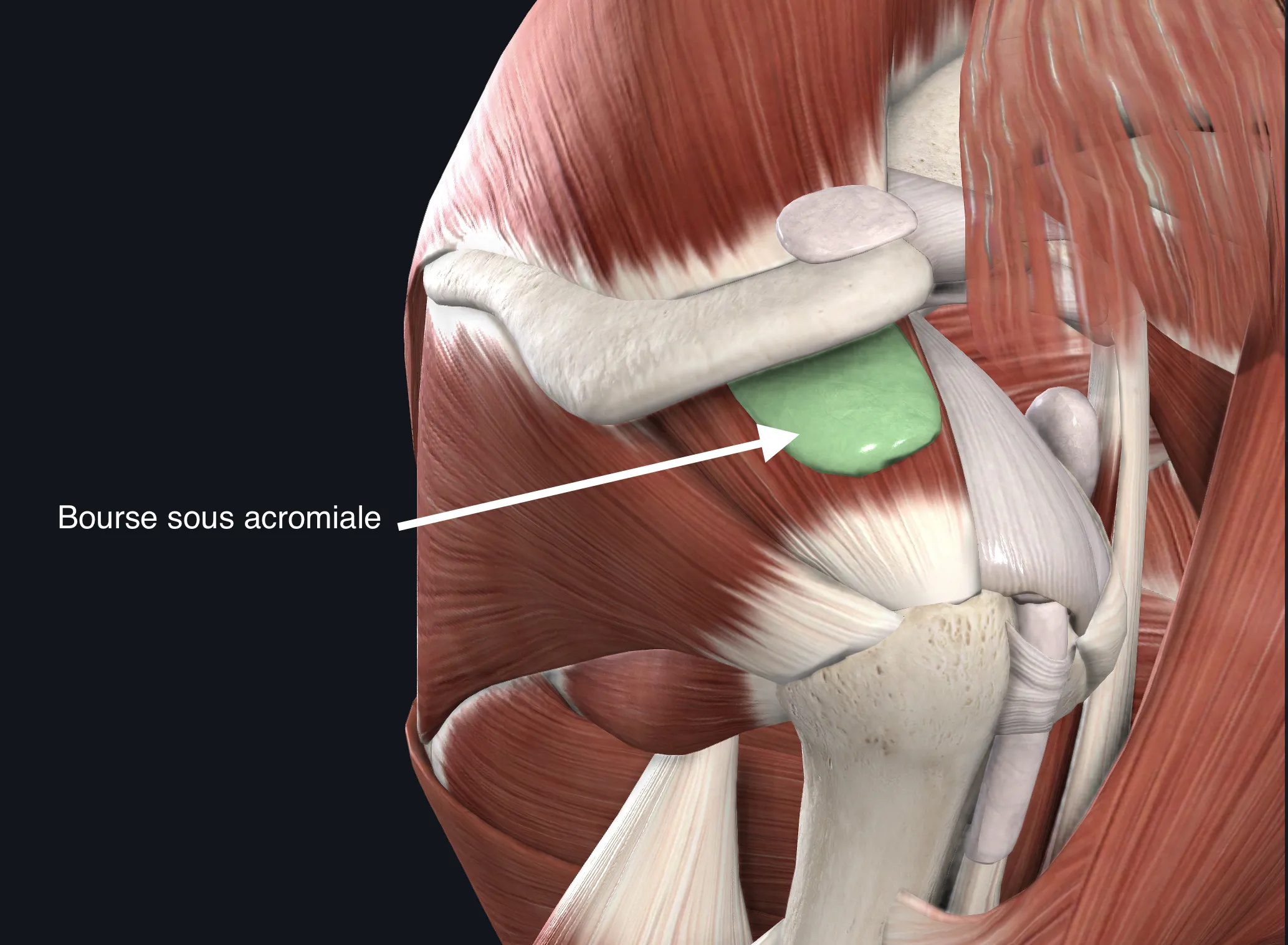 bourse sous acromiale