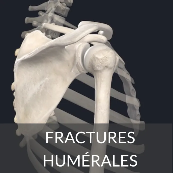 fracture-humerus