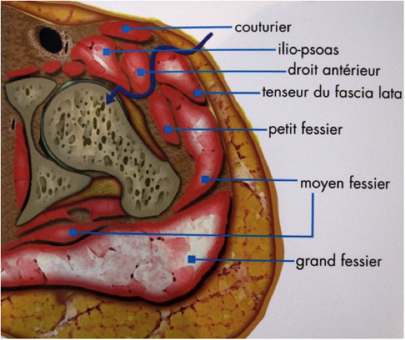 Voie antérieure mini-invasive — prothèse de hanche Montpellier