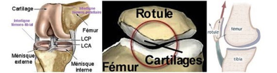 La rotule — articulation fémoro-patellaire