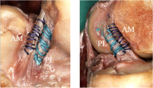 les ligaments croisés