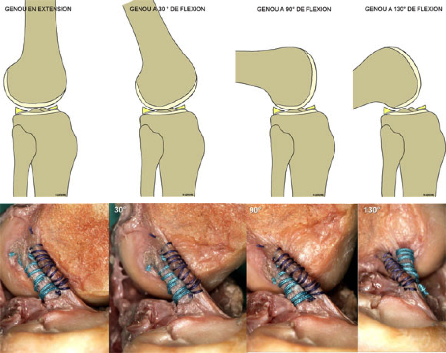 biomecanique du genou