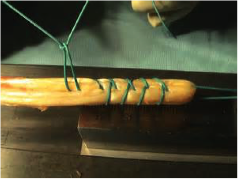 préparation plastie