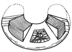 Structure fibrillaire ménisque genou Montpellier