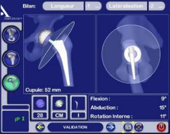 chirurgie mini-invasive
