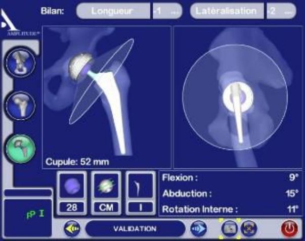 chirurgie mini-invasive